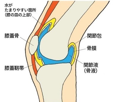 に が 理由 水 膝 溜まる 【ツボ】水が溜まった膝痛にお勧めのツボ！おかだ鍼灸院