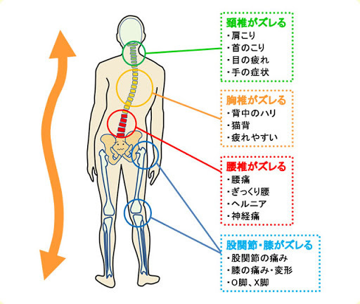 身体の歪み図