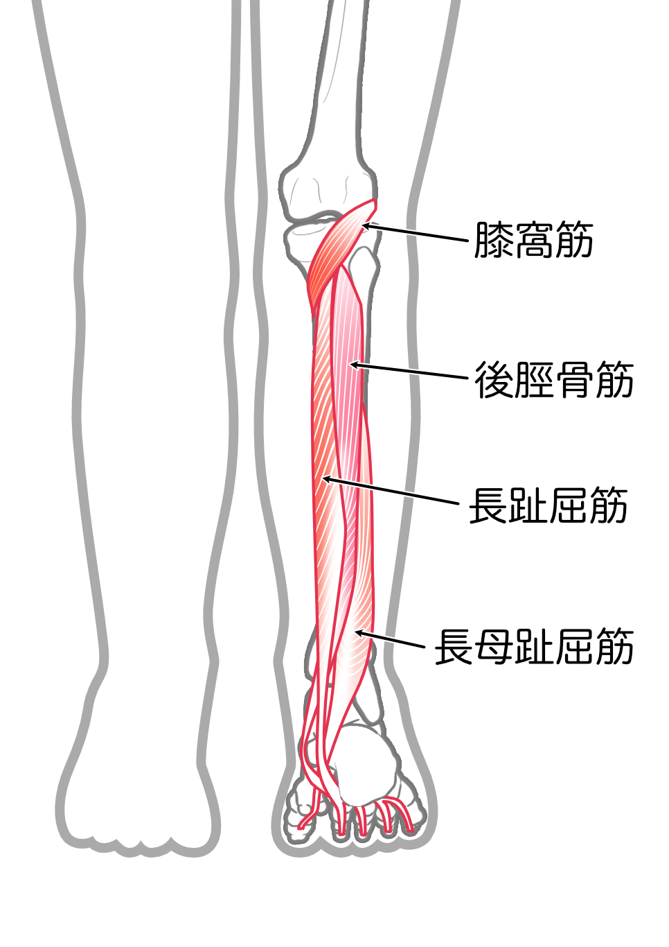 足根管症候群