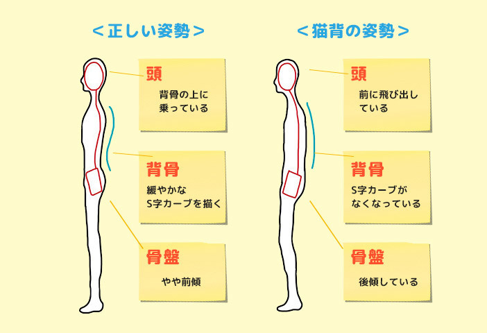 猫背の姿勢とは