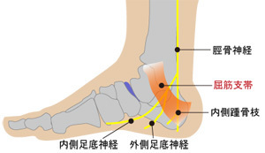 足根管症候群