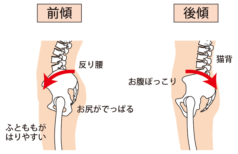身体の歪み図