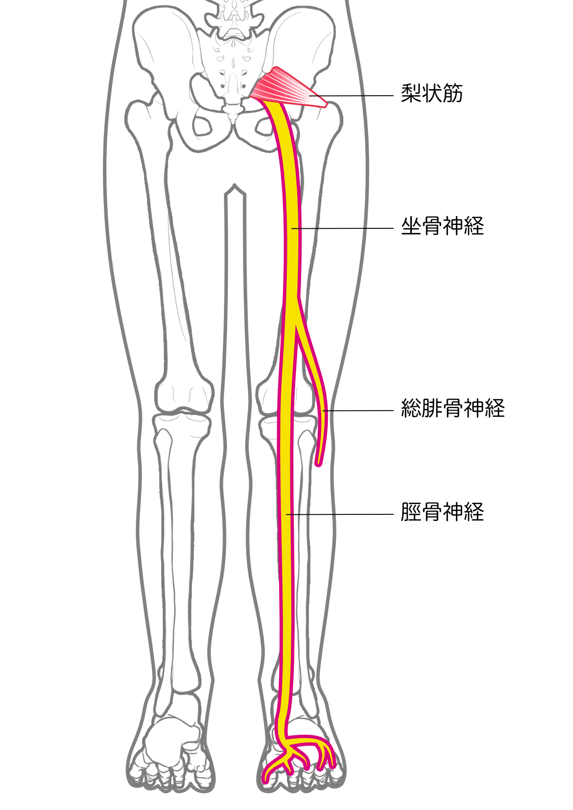 腓骨神経麻痺