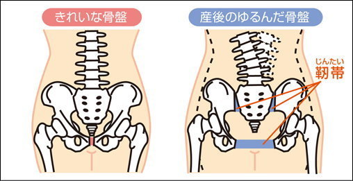 骨盤の歪み